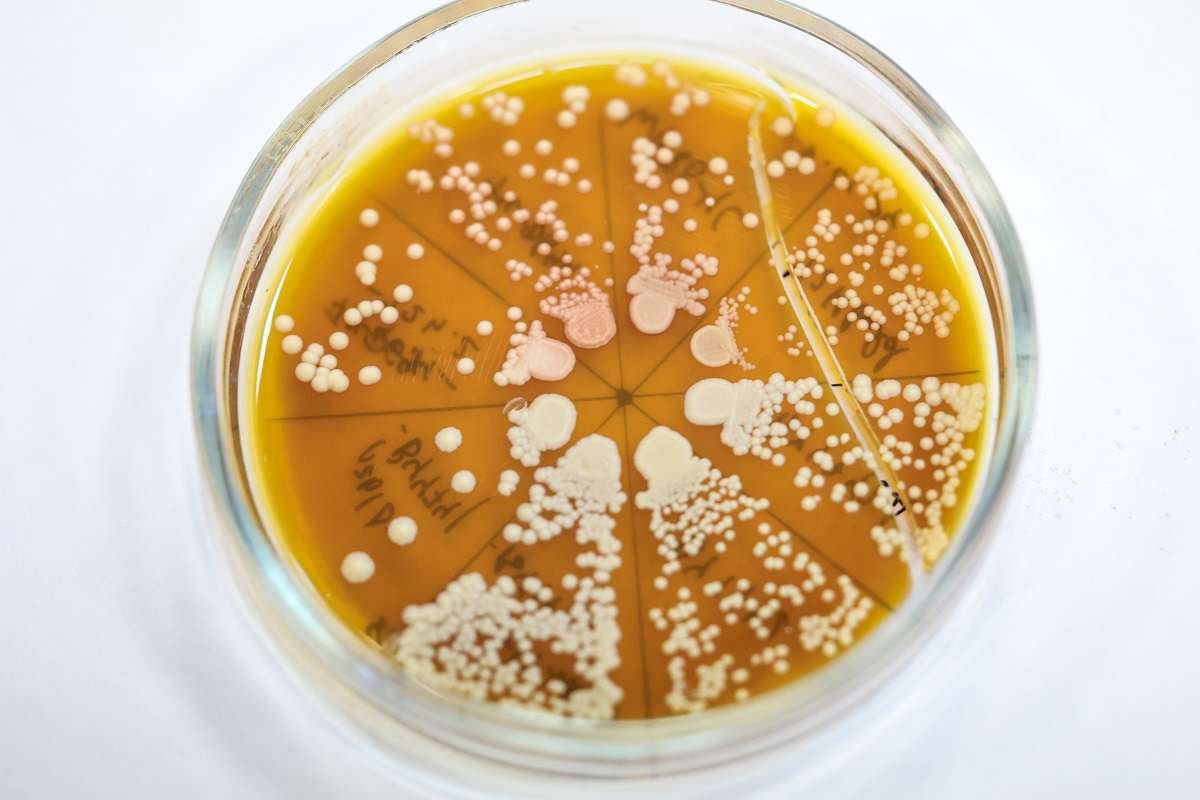 Collection of&nbsp;baker&rsquo;s yeast strains (Saccharomyces cerevisiae) from St&nbsp;Petersburg University&rsquo;s genetic collections. Photo by&nbsp;Aleksei Loshchilov