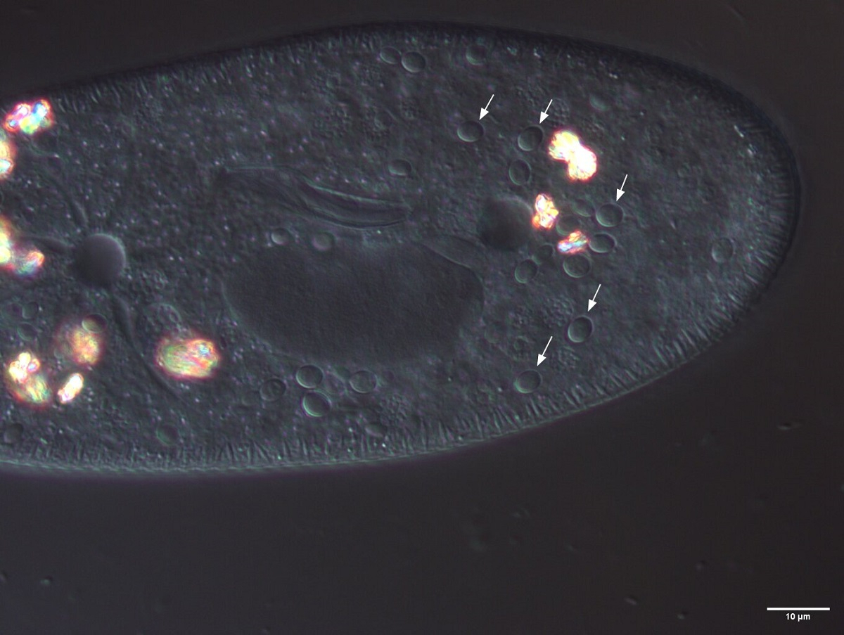 Yeast Rhodotorula mucilaginosa in the cytoplasm of ciliates (indicated by arrows), light microscopy, Nomarski interference contrast. Courtesy of Elena Sabaneeva