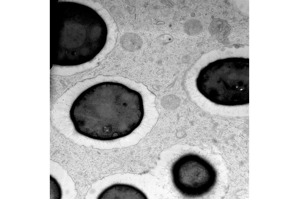 Yeast cells in the cytoplasm of a ciliate, captured using electron microscopy. Courtesy of Elena Sabaneeva